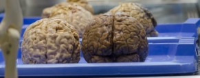 Vers une nouvelle neuroesthétique élargie